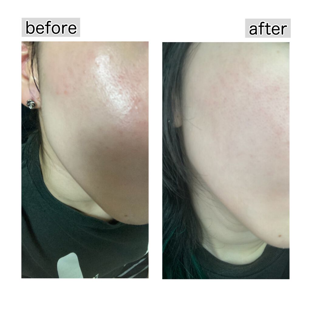 弱酸性レッドブレミッシュクリアスージングフォーム/Dr.G/洗顔フォームを使ったクチコミ（3枚目）