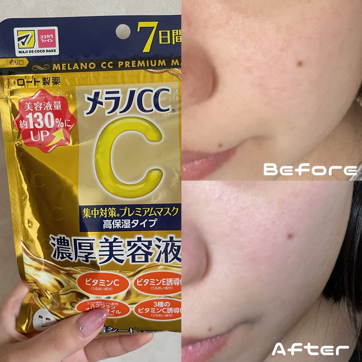 集中対策プレミアムマスクMK 高保湿タイプ/メラノCC/シートマスク・パックを使ったクチコミ(1枚目)