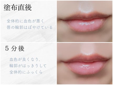 ドトムリッププラスプランパー/keybo/リッププランパーを使ったクチコミ(2枚目)