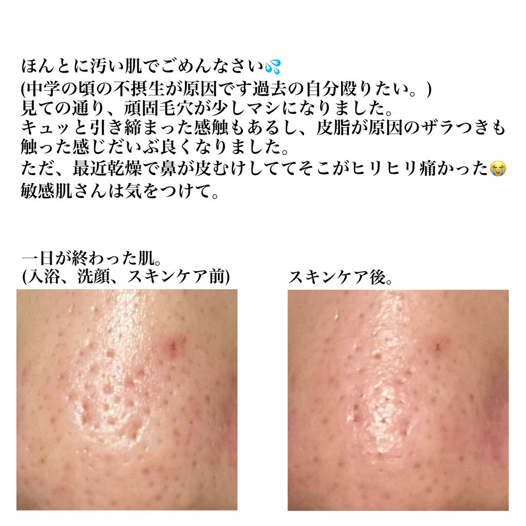 BHクリアノーズパック/CucuporeC/シートマスク・パックを使ったクチコミ（2枚目）