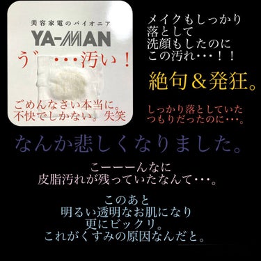 ヤーマン RFボーテ フォトPLUSのクチコミ「
𓂃𓈒𓏸

こんにちは⑅︎◡̈︎*
スンミンです₍ᵔ· ̫·ᵔ₎

𓂃𓈒𓏸

今日は

美容家.....」（2枚目）