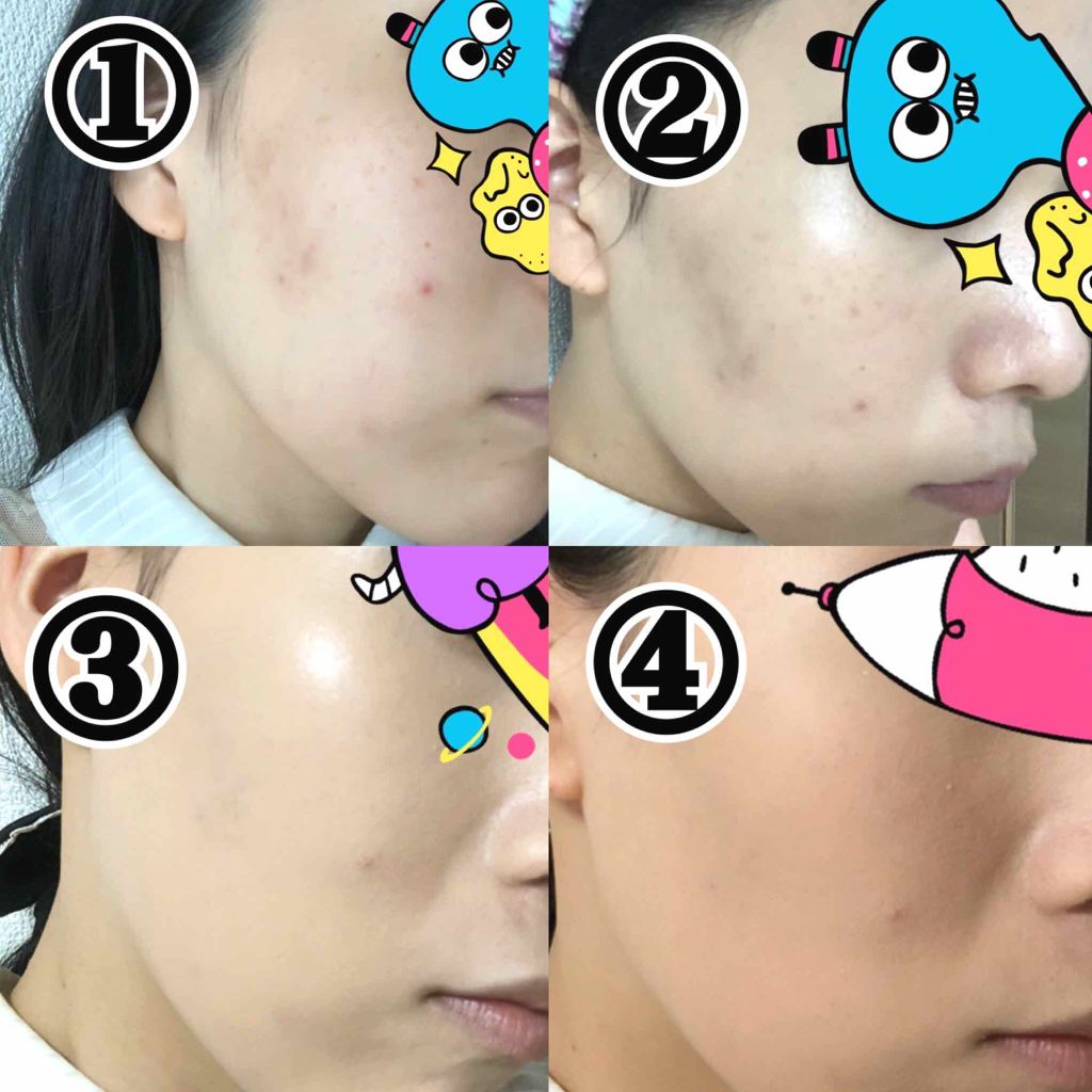 カバーパーフェクション チップコンシーラー/the SAEM/リキッドコンシーラーを使ったクチコミ(1枚目)