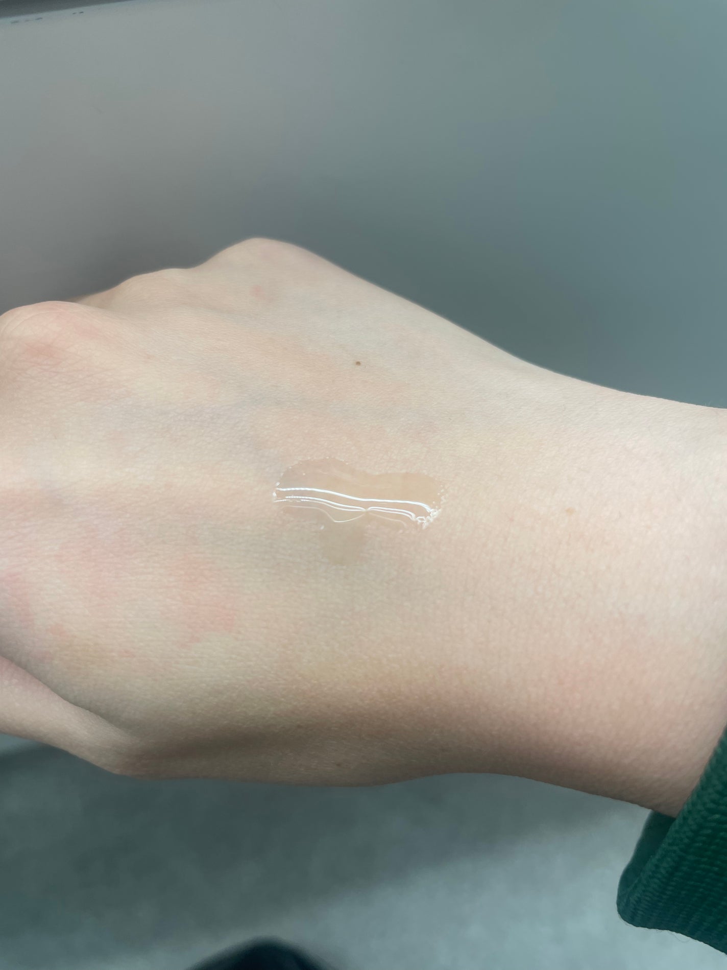 RXザ・アルファアルブチン2 ニキビ跡ケアセラム/COSRX/美容液を使ったクチコミ(3枚目)