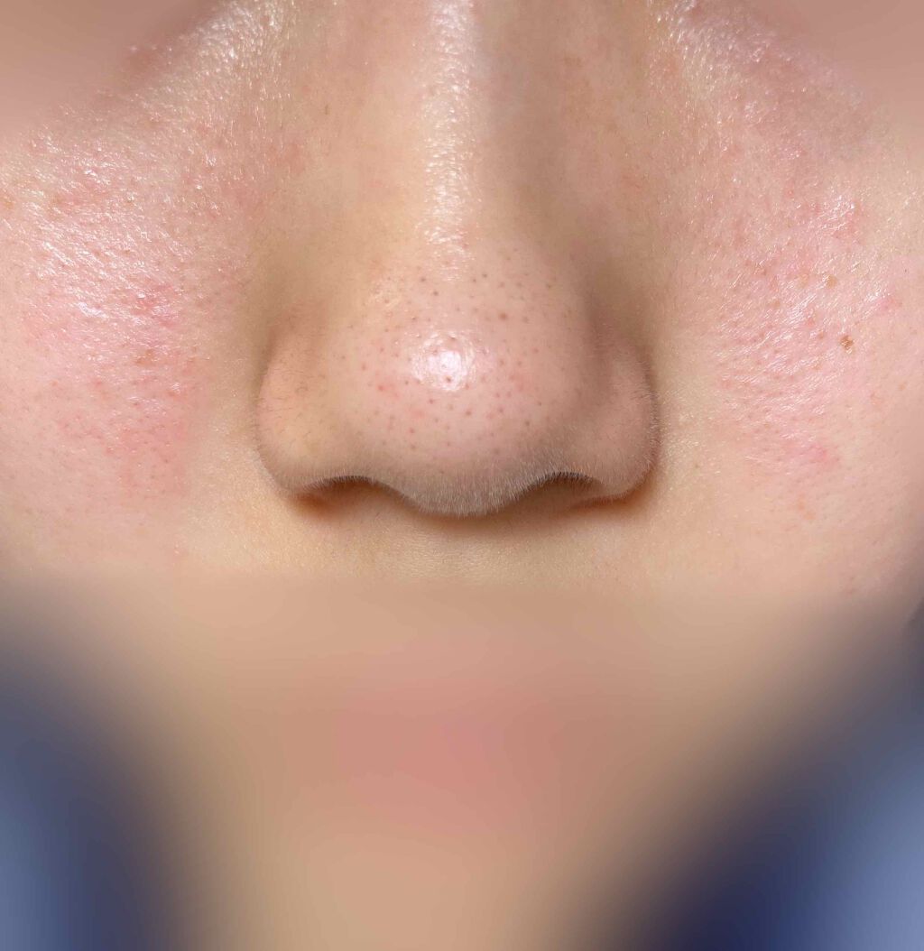 まる on LIPS 「こんなサムネイルで開いてくれた方ありがとうございます。本当に感..」(3枚目)