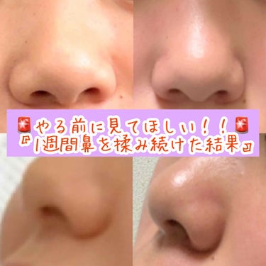 さとみや on LIPS 「こんにちは！さとみやです(^^)前回の初投稿たくさんのいいねあ..」（1枚目）