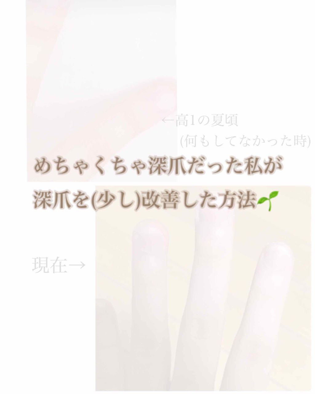ネイルトリートメント N/ネイルネイル/ネイルオイル・トリートメントを使ったクチコミ(1枚目)