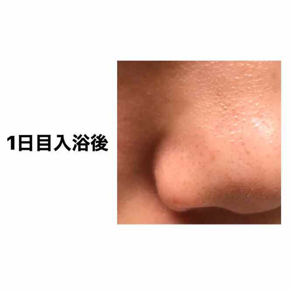 ジョンソン ベビーオイル 無香料/ジョンソンベビー/ボディオイルを使ったクチコミ(3枚目)