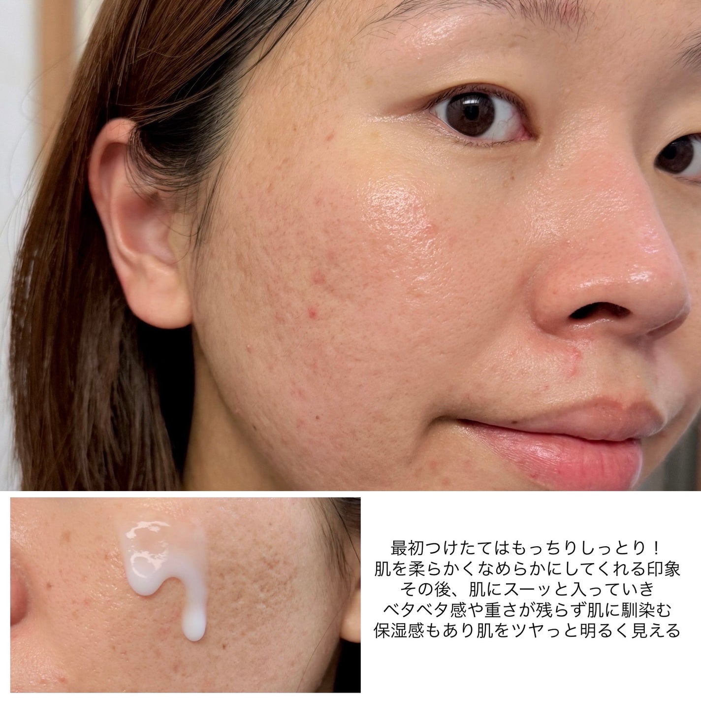 プロバイオシカ インテンシブ アンプル/SKIN1004/美容液を使ったクチコミ(6枚目)