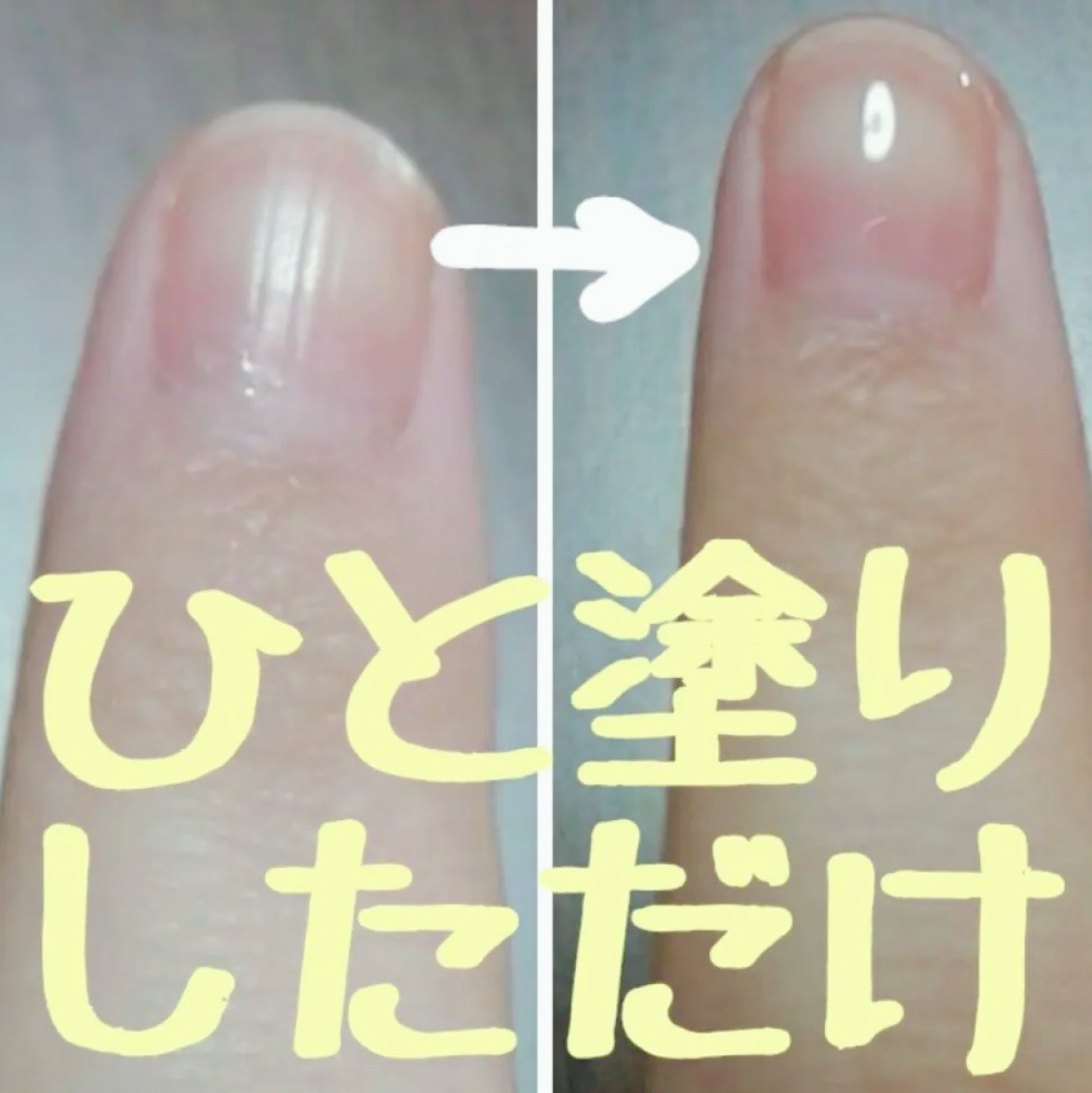 ジェルボリュームトップコート/キャンメイク/ネイルトップコートを使ったクチコミ（1枚目）