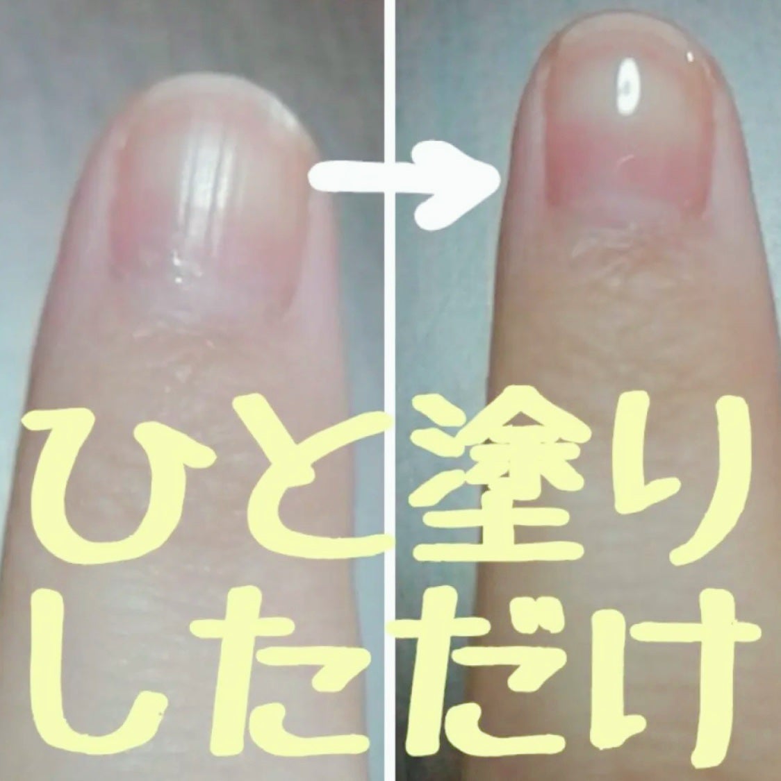 ジェルボリュームトップコート/キャンメイク/ネイルトップコートを使ったクチコミ(1枚目)