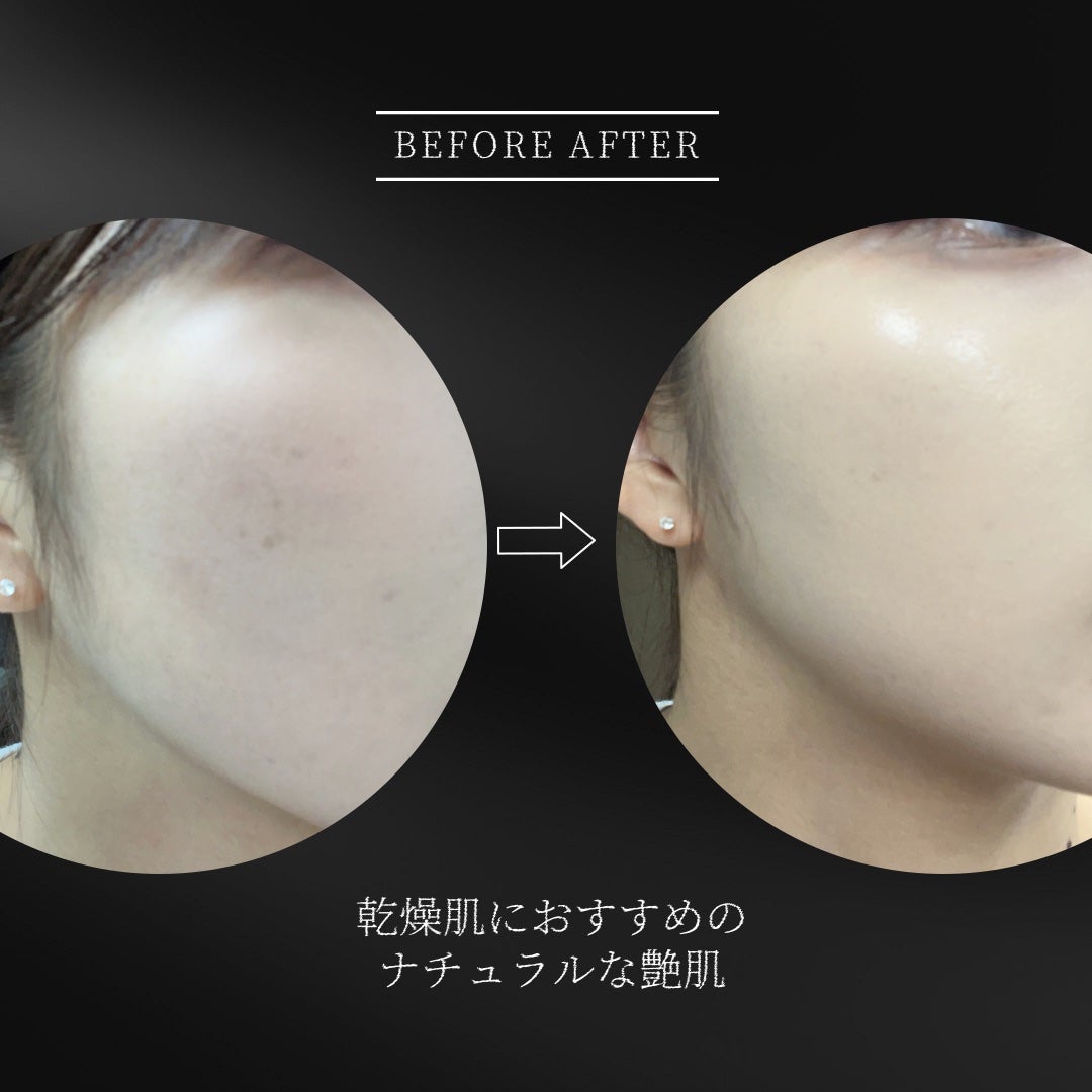 エスポア ビーグロー ボリュームクッション/espoir/クッションファンデーションを使ったクチコミ(3枚目)