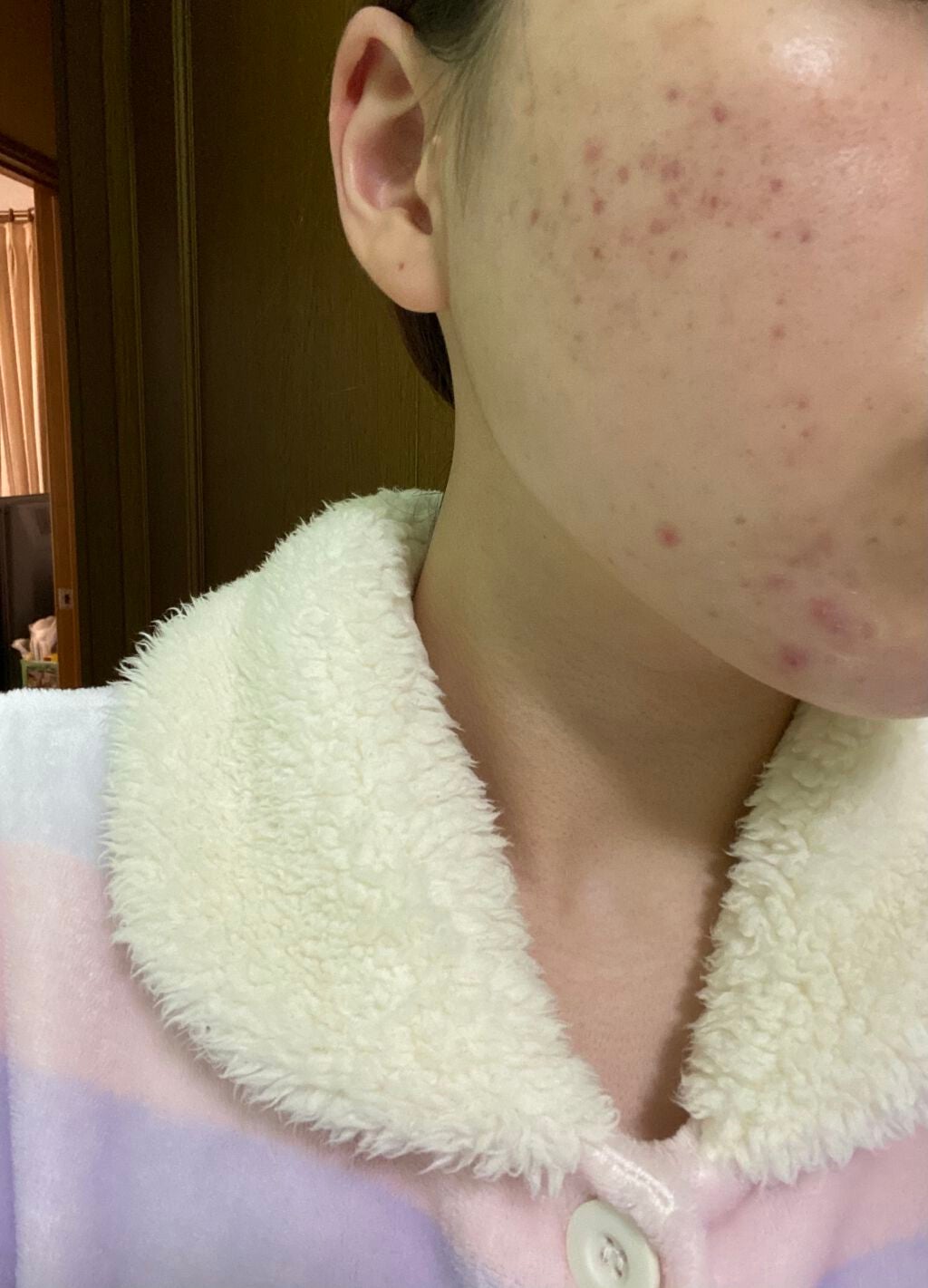 モイスチャー リッチローション(とてもしっとり)/アルージェ/化粧水を使ったクチコミ(2枚目)