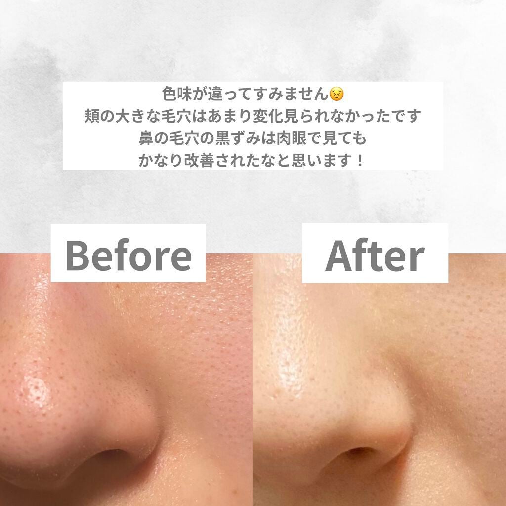 エリクシール ルフレ バランシング ウォーター II/エリクシール/化粧水を使ったクチコミ(2枚目)