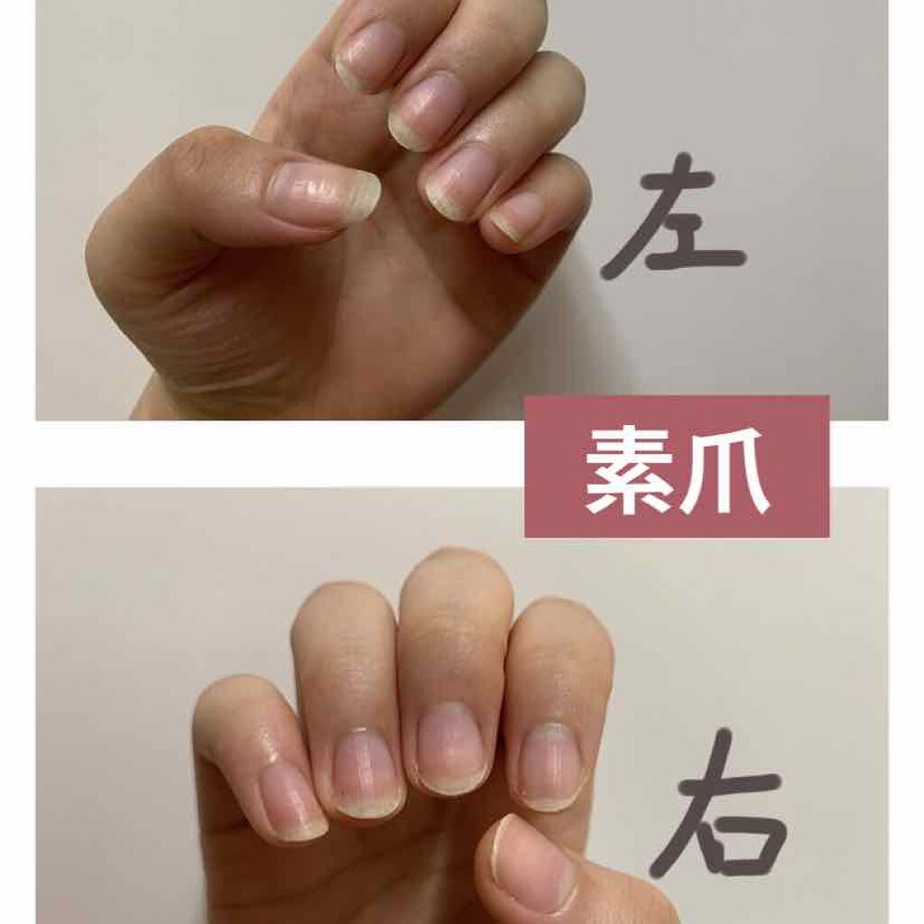 ネイルケアプロテクター/オルビス/ネイルオイル・トリートメントを使ったクチコミ（2枚目）