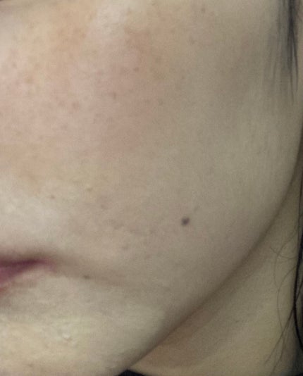 タトゥーウォータープルーフスカーコンシーラー/フォレンコス/リキッドコンシーラーを使ったクチコミ(4枚目)