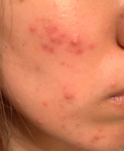 を使ったクチコミ(1枚目)