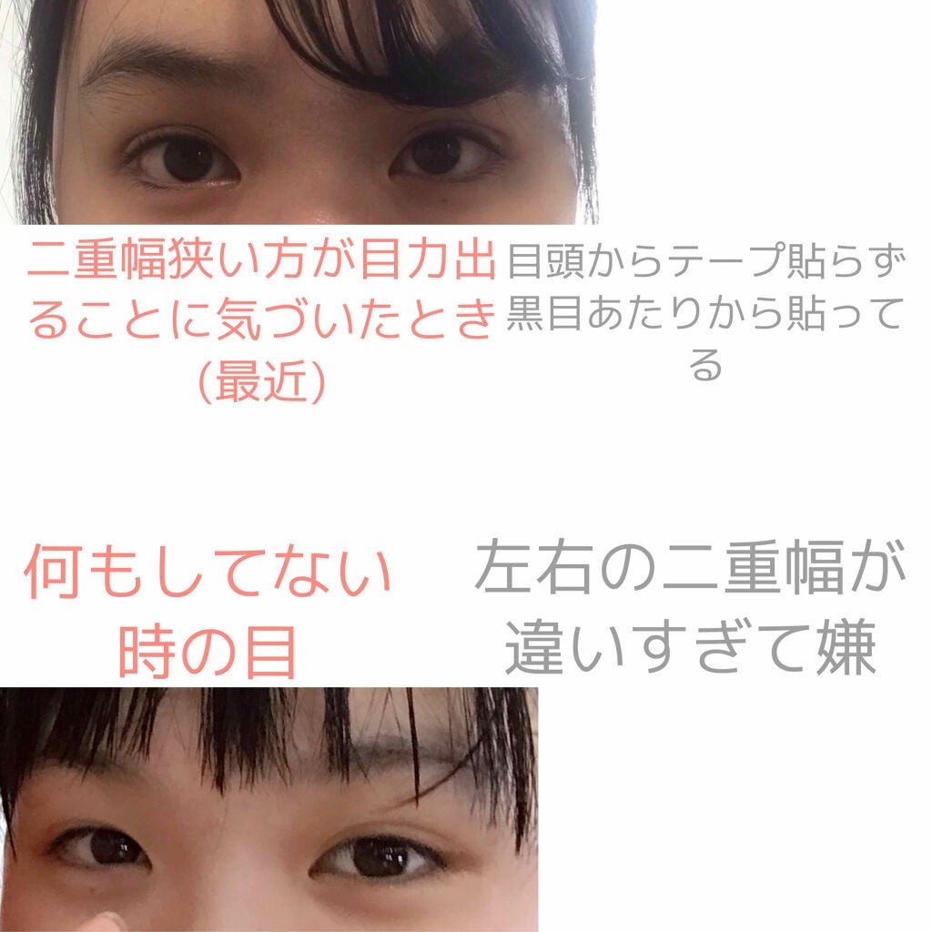 アイテープ(絆創膏タイプ、レギュラー、70枚)/DAISO/二重まぶた用アイテムを使ったクチコミ(4枚目)