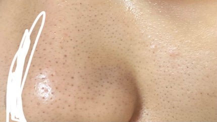 化粧水・敏感肌用・高保湿タイプ/無印良品/化粧水を使ったクチコミ(3枚目)