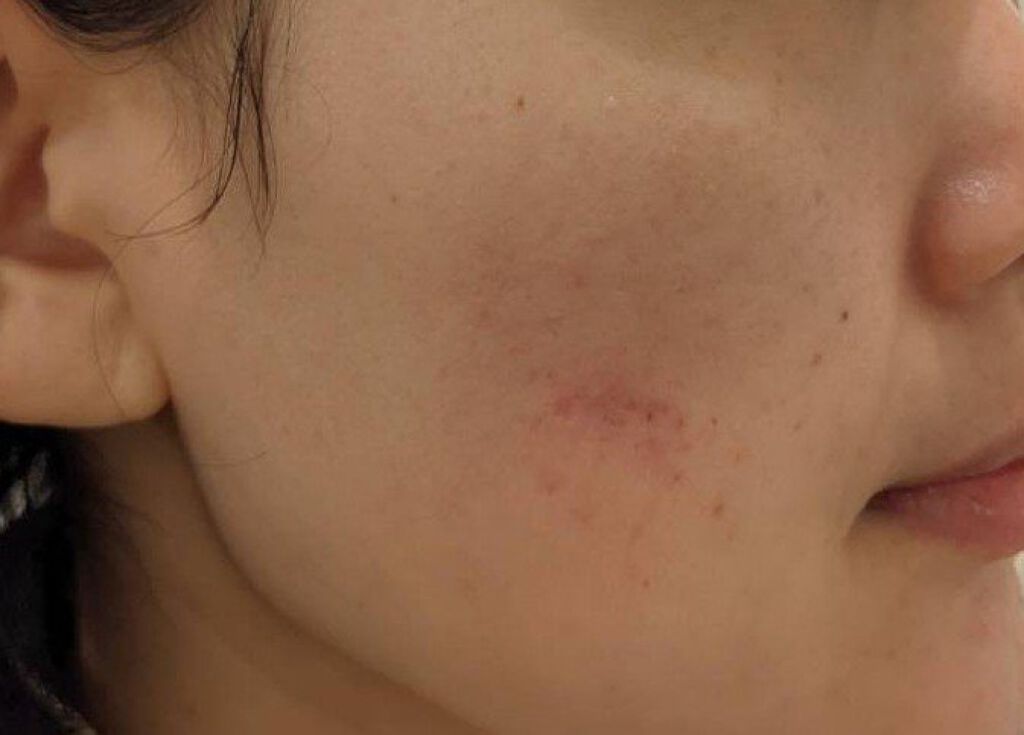 テラスキン/LINE REPAIR/美容液を使ったクチコミ（3枚目）