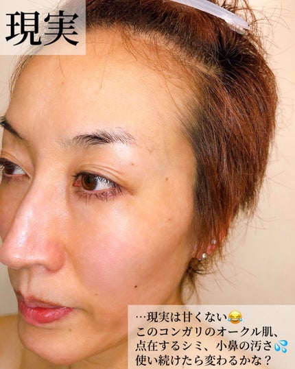 酵素洗顔パウダー/ドットバスター/洗顔パウダーを使ったクチコミ(7枚目)