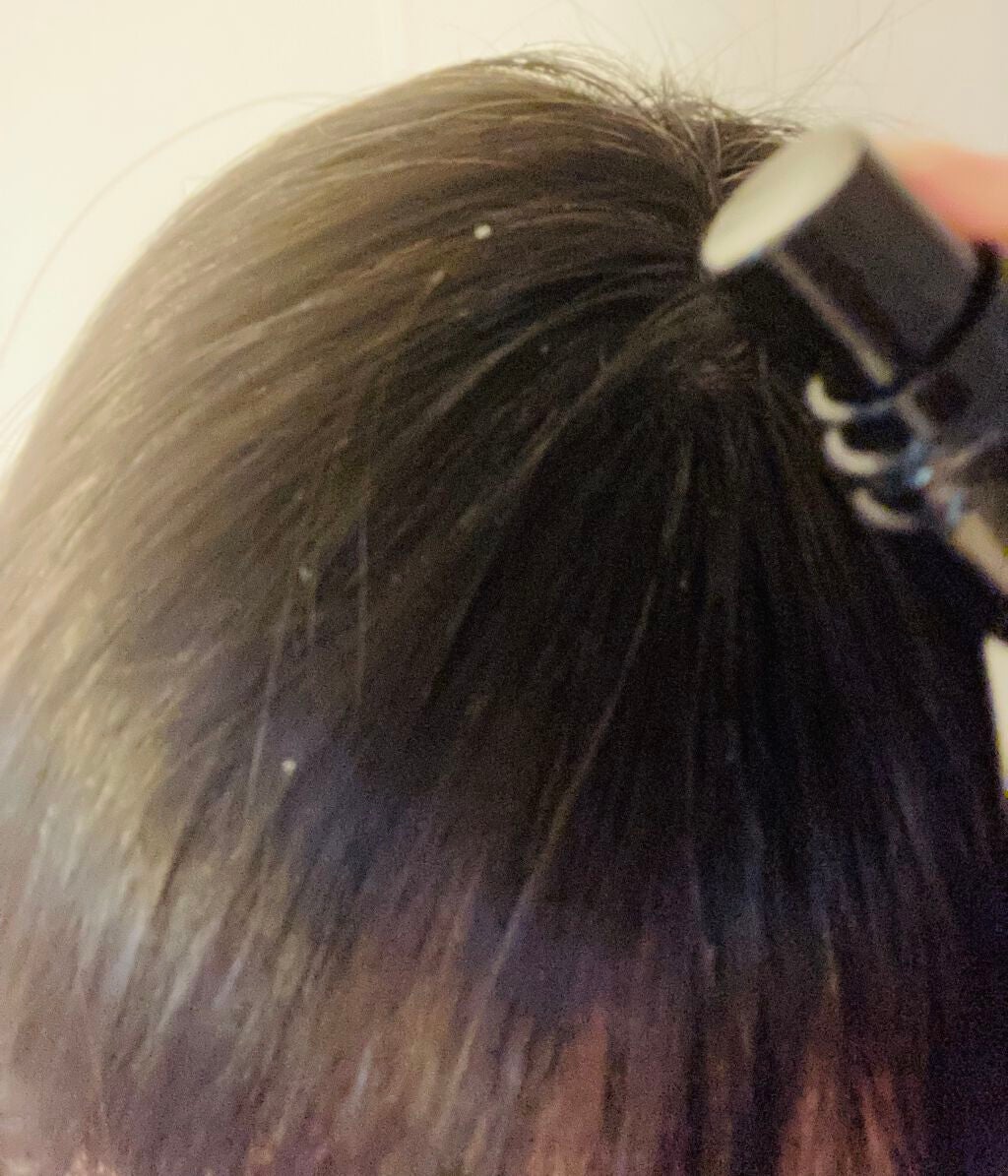 ライスコロッケ on LIPS 「【ふわ姫】女性用育毛エッセンスの紹介ですふわ姫は、抜け毛やぺた..」(5枚目)