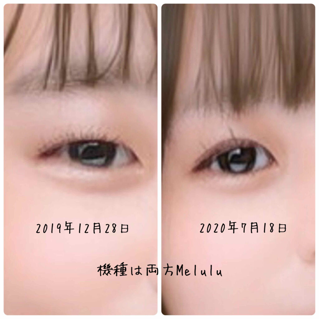 アイトーク/アイトーク/二重まぶた用アイテムを使ったクチコミ（2枚目）