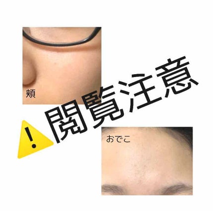 ハトムギ化粧水(ナチュリエ スキンコンディショナー R )/ナチュリエ/化粧水を使ったクチコミ(2枚目)