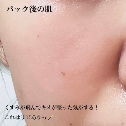 ルルルン ハイドラ EX マスク/ルルルン/シートマスク・パックを使ったクチコミ(3枚目)