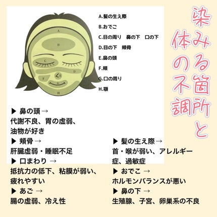 美容原液 オパール R-III/薬用 オパールR-Ⅲ/美容液を使ったクチコミ(2枚目)