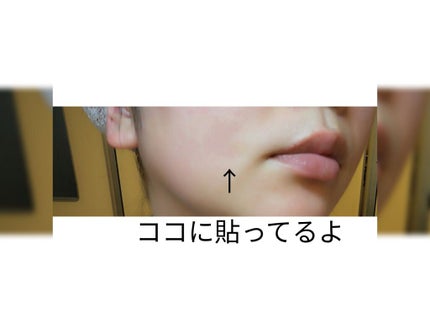 ゼロスポットパッチ/Today’s Cosme/にきびパッチを使ったクチコミ(4枚目)