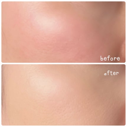 タンイドル ウルトラ ウェア リキッド N/LANCOME/リキッドファンデーションを使ったクチコミ(6枚目)