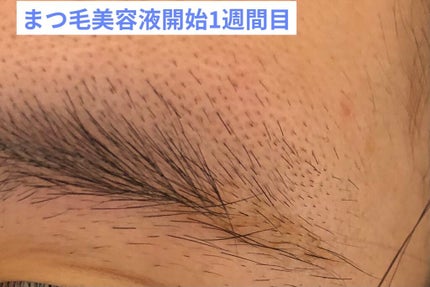 スカルプD ボーテ ピュアフリーアイブロウセラム/アンファー(スカルプD)/その他アイブロウを使ったクチコミ(3枚目)