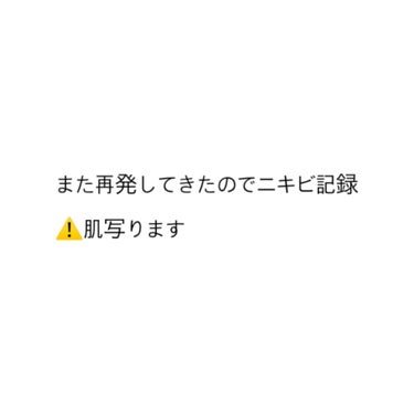 ちょっと期間空いたのですが肌記録、
前回から12日経ちました。その間に生理きたので生理前の肌荒れがおさまり、大きいニキビも引いてきました。本当に良かった…。生理前のニキビできなくさせたい



〜〜〜
