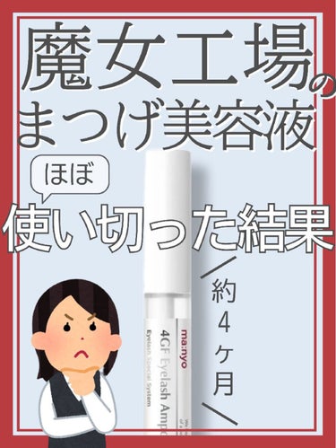 【\LIPSショッピングで購入/魔女工場のまつげ美容液🧐約4ヶ月使ってみた結果…】




◎魔女工場
    4GFアイラッシュアンプル



まつげ美容液はガチで10何年ぶりだってくらい、
久々に使いましたわ…
まつげ美容液は絶対使ったほうがいい！
という意見が多かったので、
とは言えどれを買えばいいかわからないし、
ピンキリだし、失敗したりまぶたにダメージがあっても怖いし
LIPSショッピングでポイントで購入できて、
かつ評価もそれなりで、安全に使えそうという理由で
魔女工場のまつげ美容液を使ってみた次第🙄🙄


結論から言うと、
明らかな効果はなかったかな…？

正面とかから見た時に
あきらかに伸びましたなという実感はなく…

ただ、気のせいかもしれないですが
よーーーく見ると、こんなとこに毛ありましたっけ？
というようなうぶ毛が生えていたり…
(上まぶたのまつげの生え際よりちょっと離れたとこにうぶ毛があったり、目頭の粘膜に近いところから生えていたり)

けどまつげ美容液を使う前は
まぶたを凝視することもあまり無かったので
不確実ではありますが…


でもあくまでこれは伸ばすというよりは
【弱ったまつげを健康的に強くする】
という製品ですので、
伸びるとは違うのかなと思いつつも
弱ったまつげが強くなる→おのずと伸びる 
とも言えそうだが…
元々健康的だったまつげに使ってもあまり効果は
ないのかもしれません🙄
まつげが抜けまくったり、ヒョロヒョロになってしまっている方向けかな？


韓国のまつげ美容液界隈では評価も高いですし、
LIPSのポイントで買えるのもあって試しやすいかと…！
眉毛にも使えるので、私は眉毛にも使ってます🥳

ただ目に入ると少ししみるのでそこは注意⚠


#魔女工場#4GFアイラッシュアンプル#まつ毛美容液#まつ育#マツ育#正直レビュー#私のメイク必需品
の画像 その0