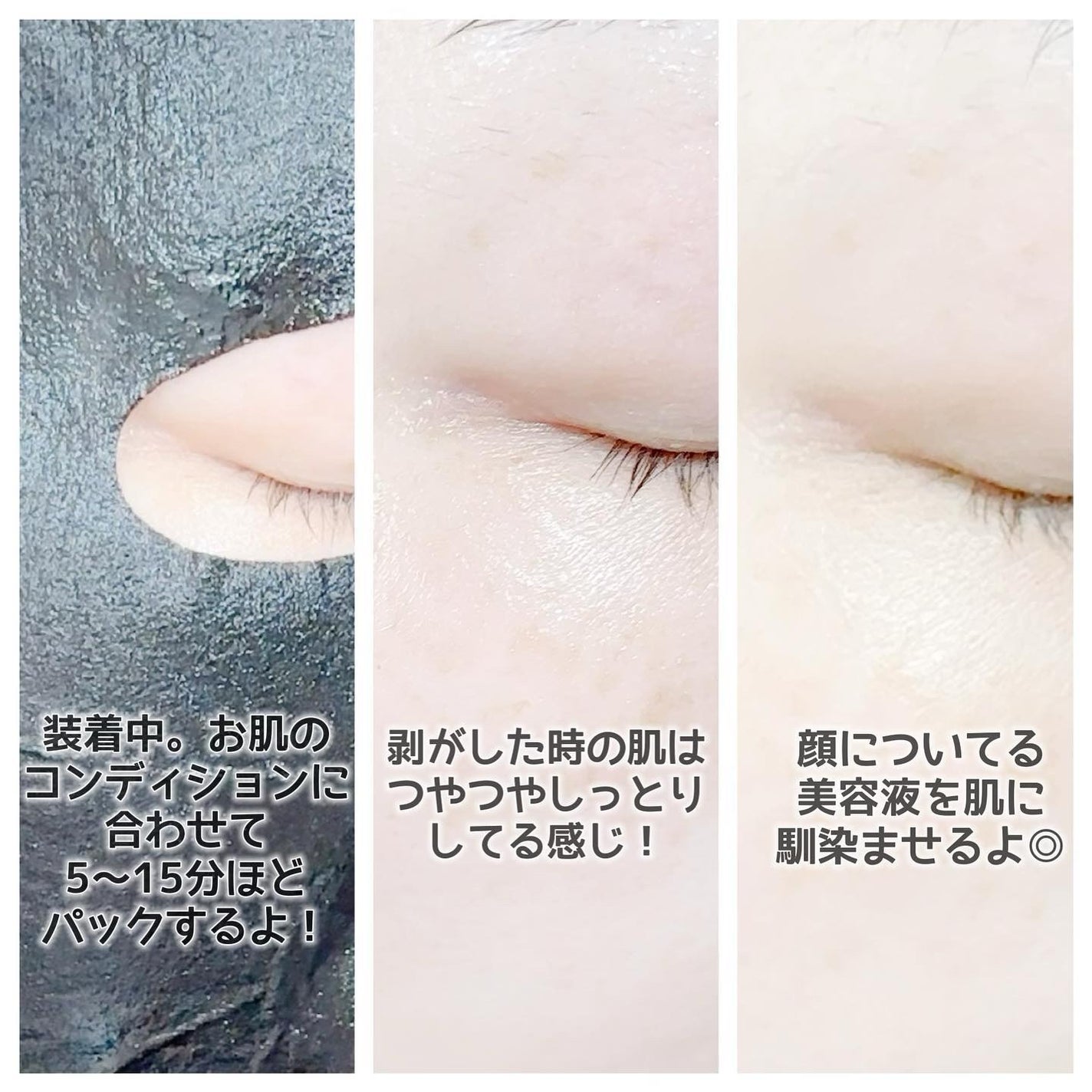 ピュアブラック アクアモイスチャー シートマスク/ALFACE+/シートマスク・パックを使ったクチコミ(4枚目)