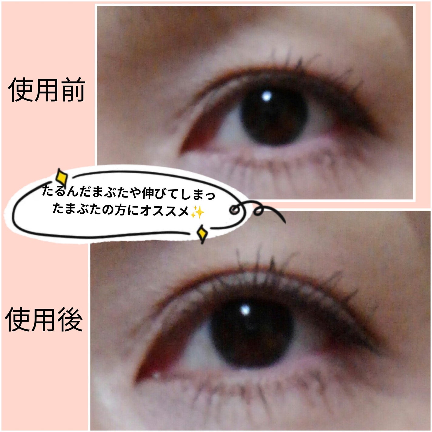 大人のルドゥーブル/ルドゥーブル/二重まぶた用アイテムを使ったクチコミ(6枚目)