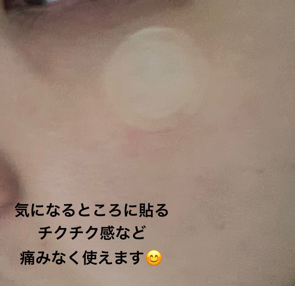 みいにゃん on LIPS 「medicubeから新発売♥️✼••┈┈••✼••┈┈••✼•..」(2枚目)