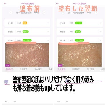 美肌測定器/COSBEAUTY/その他スキンケアグッズを使ったクチコミ（2枚目）