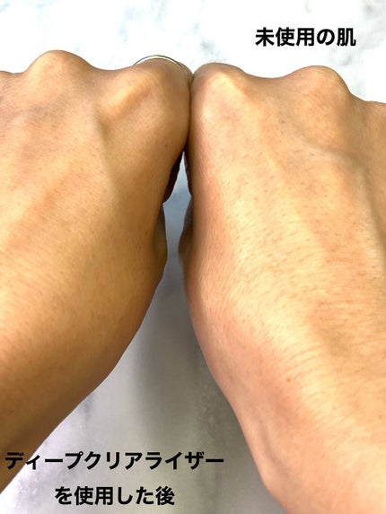 B.A ディープクリアライザー/B.A/洗顔フォームを使ったクチコミ(5枚目)