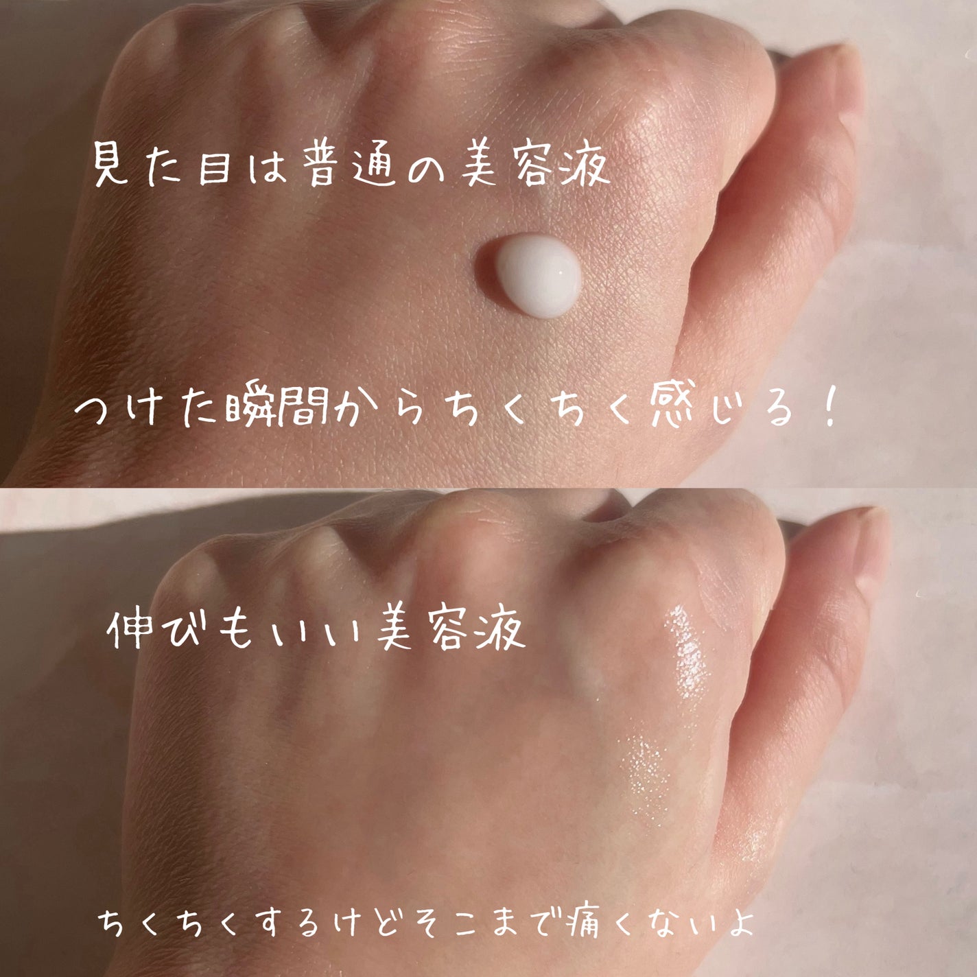 リードルショット100/VT/美容液を使ったクチコミ(2枚目)