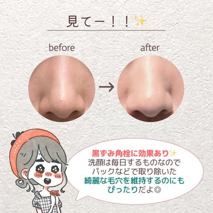 ブラックダイヤ/ラッシュ/その他洗顔料を使ったクチコミ(7枚目)