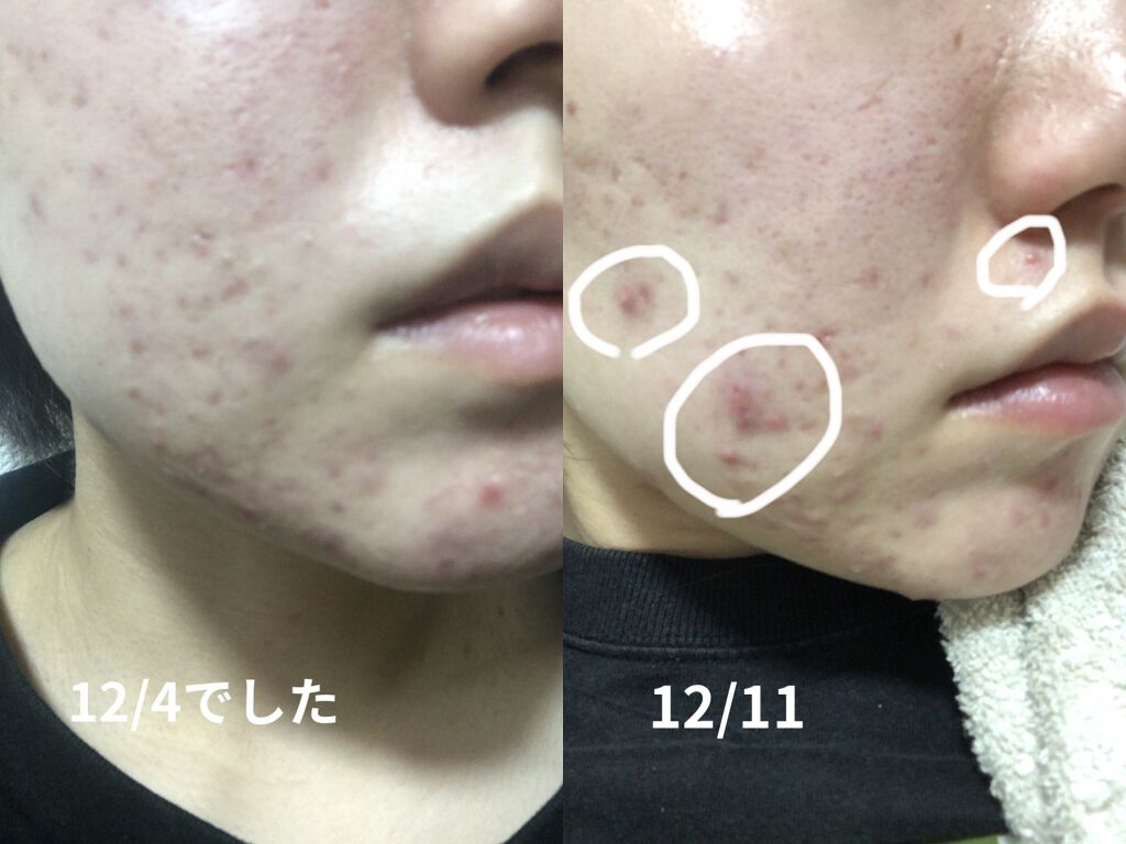 ハーバリズム/ラッシュ/その他洗顔料を使ったクチコミ（2枚目）