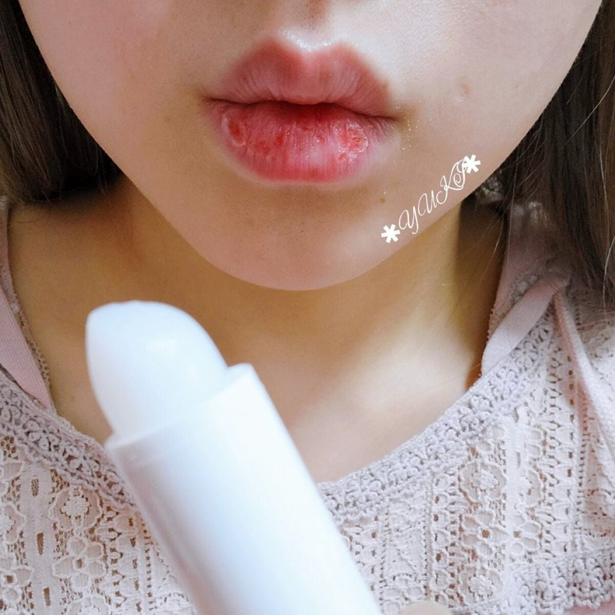 モイスチャーリップ 無香料/ニベア/リップクリームを使ったクチコミ(7枚目)