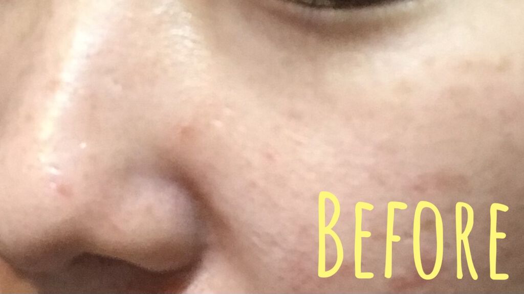 CICA カプセルマスク/VT/洗い流すパック・マスクを使ったクチコミ（2枚目）