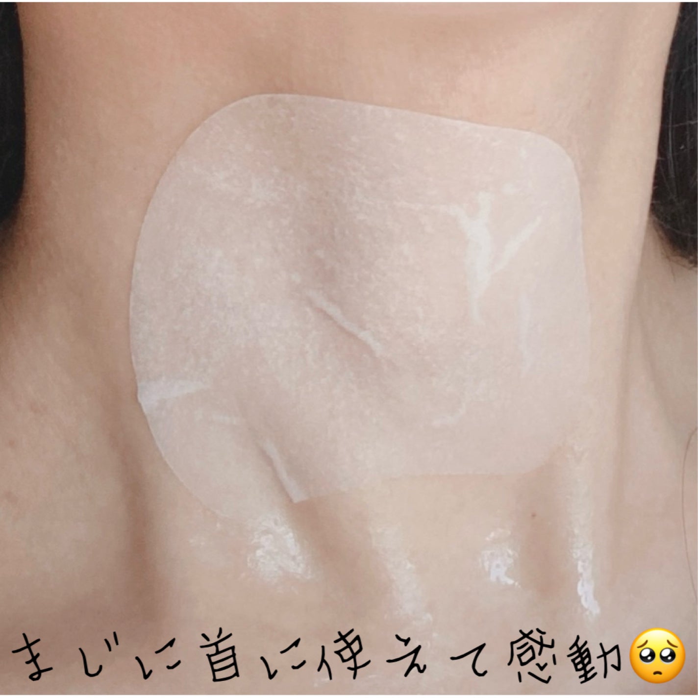 センテラ クイックカーミングパッド/SKIN1004/トナーパッドを使ったクチコミ(3枚目)