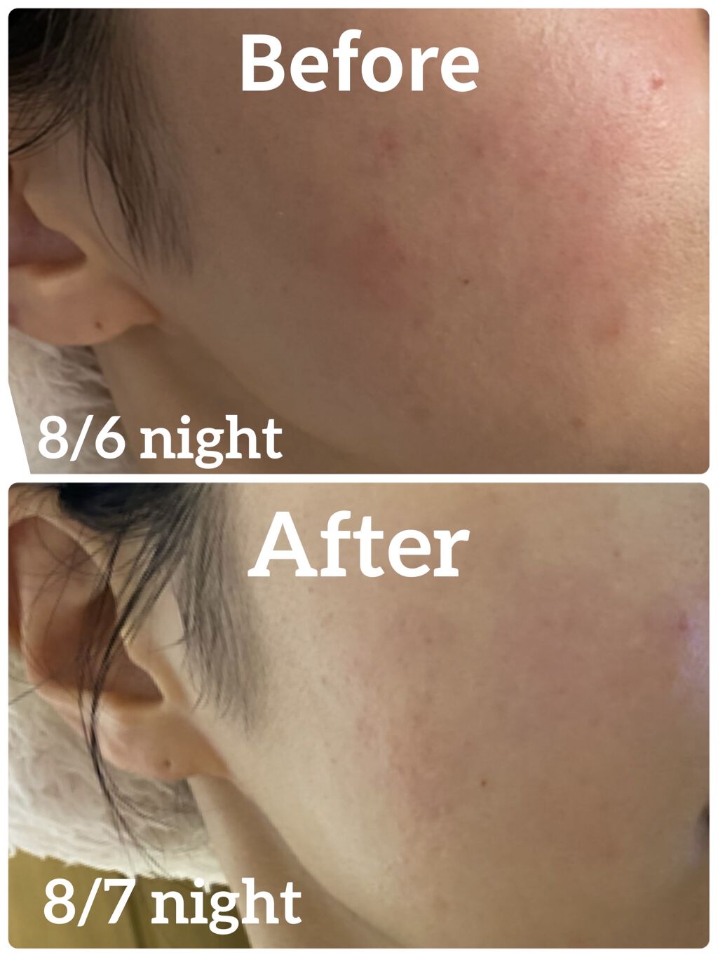 キュアレア（医薬品）/キュアレアa/その他を使ったクチコミ（3枚目）