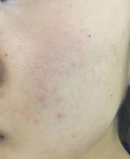 敏感肌用薬用美白美容液/無印良品/美容液を使ったクチコミ(2枚目)