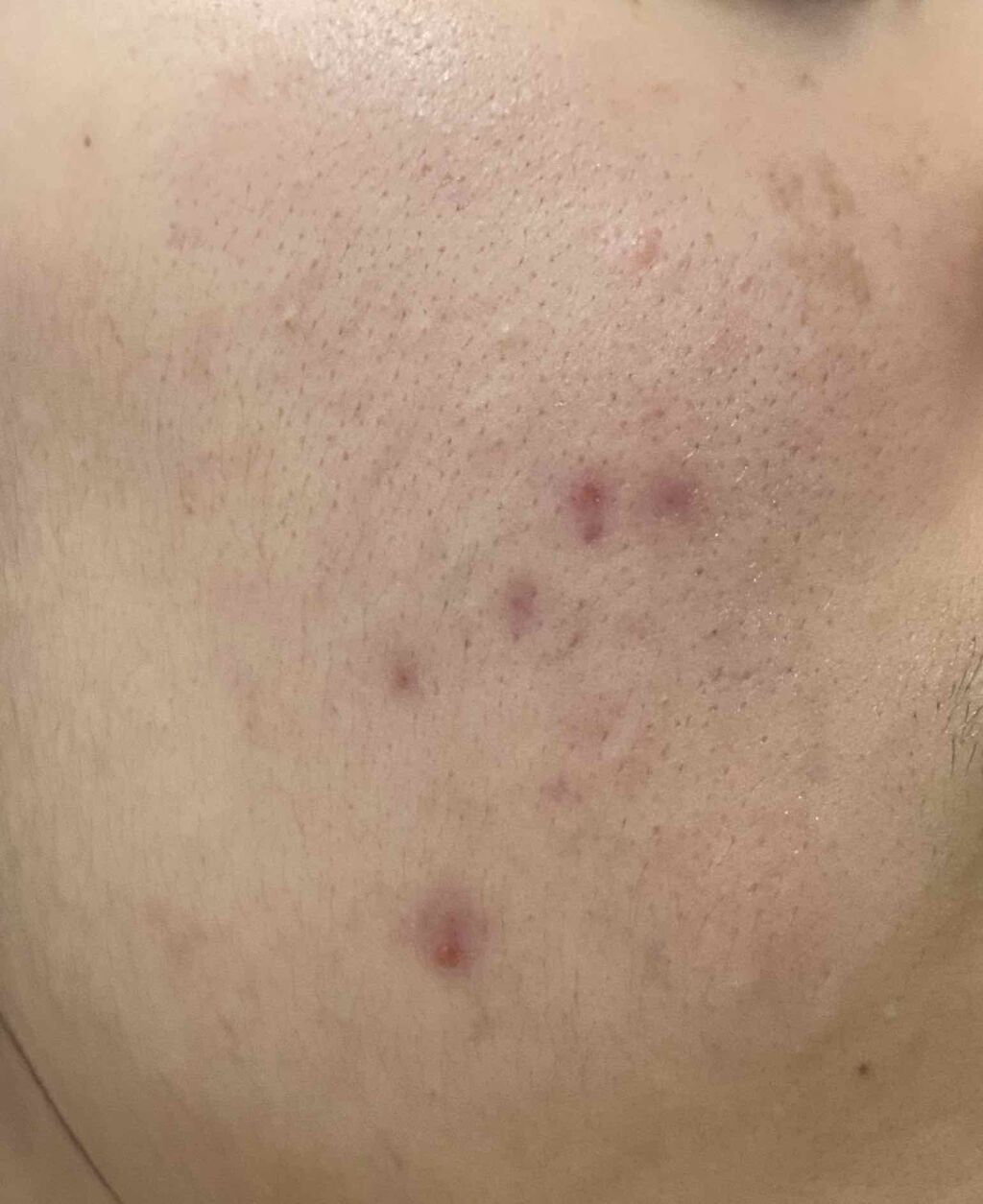 クナイプビオ オイル/クナイプ/ボディオイルを使ったクチコミ(2枚目)