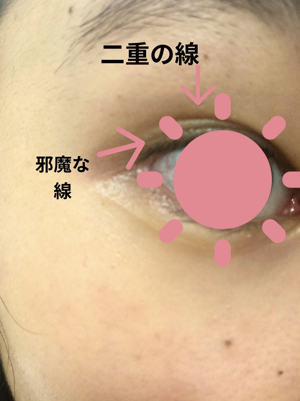 のびーるアイテープ（絆創膏タイプ、レギュラー）/DAISO/二重まぶた用アイテムを使ったクチコミ（2枚目）