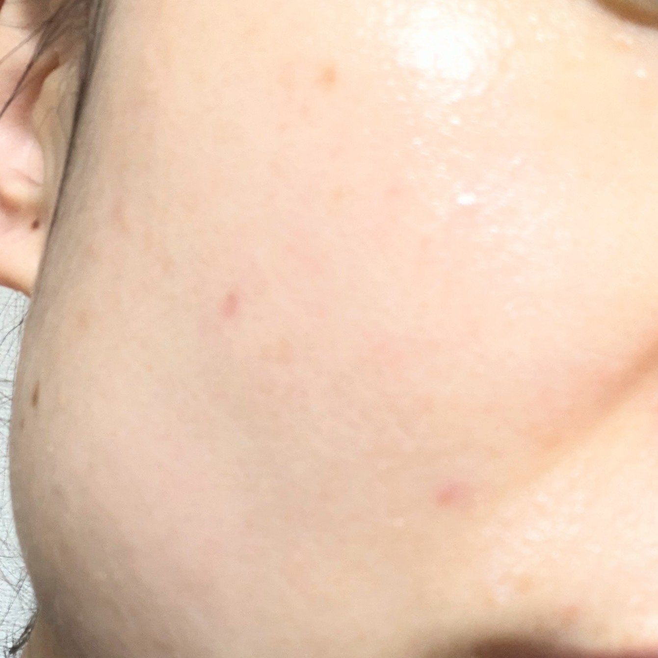 プロバイオシカ インテンシブ アンプル/SKIN1004/美容液を使ったクチコミ(4枚目)